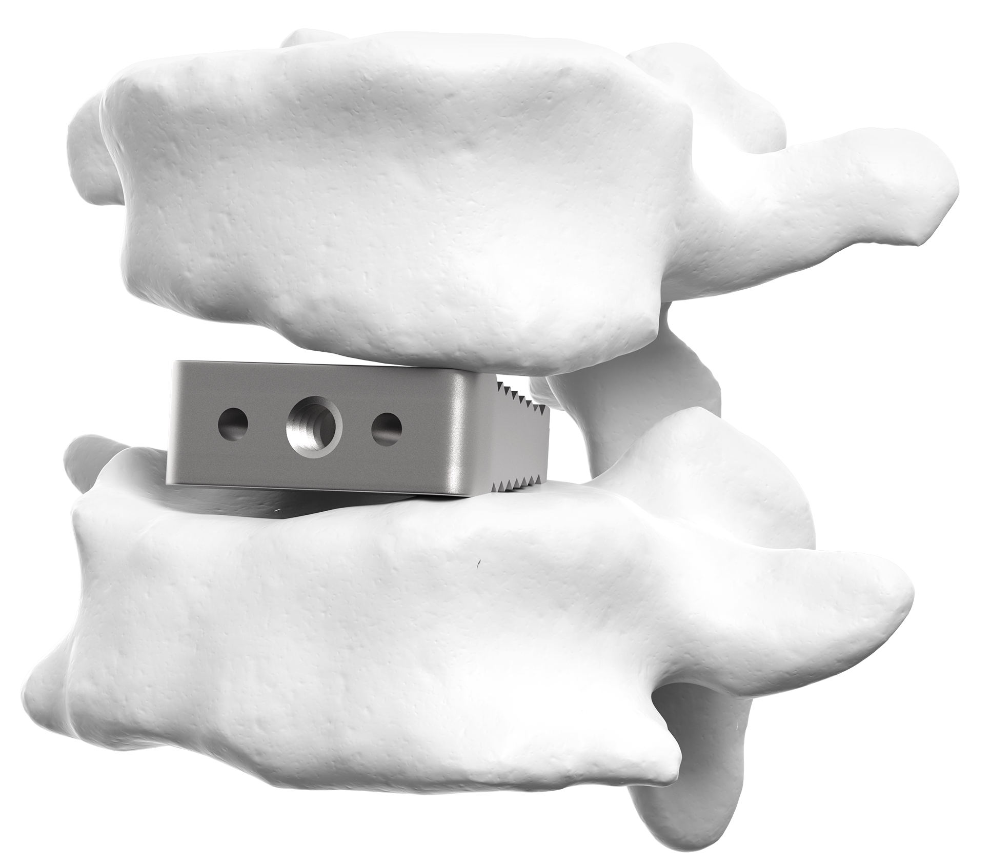 titanium block basic